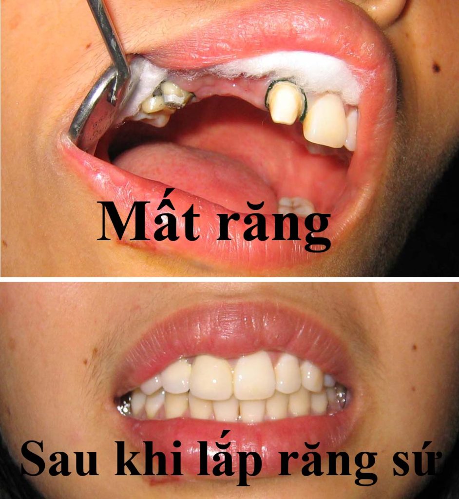 Răng hàm mặt