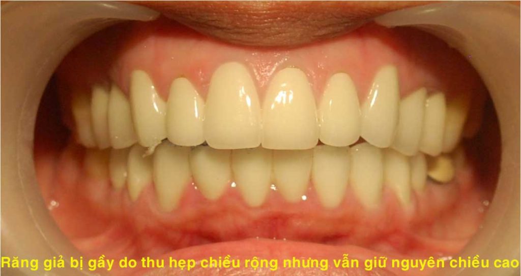 Răng hàm mặt